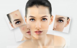 Alternanța-sezonieră-crono-dermatologia-și-schimbările-hormonale-influențează-pielea