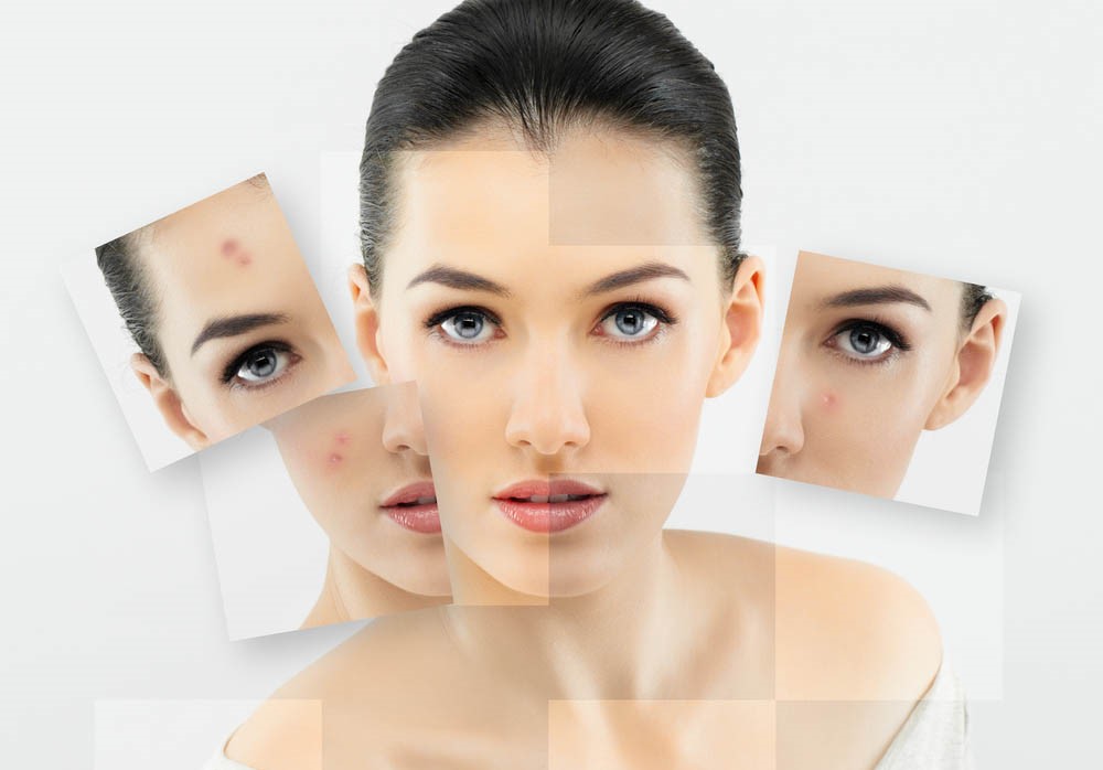 Alternanța-sezonieră-crono-dermatologia-și-schimbările-hormonale-influențează-pielea